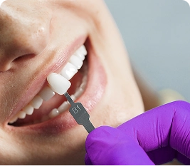 Veneer សេរ៉ាមិច