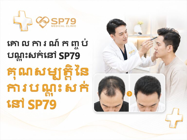 ផ្ទាំងបដាគោលការណ៍កញ្ចប់ដាំសក់នៅ SP79